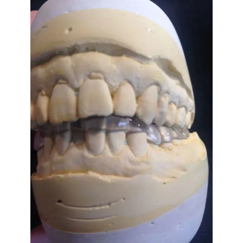 Clear PMMA Monolayer Dental Disc for Temporary Crowns and Bridges