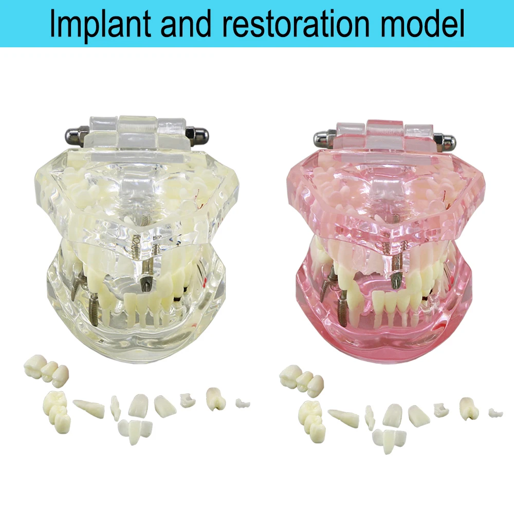 

Dental Model With Removable Teeth Dental Teaching Models Teeth Implant Restoration Bridge Teaching Demonstration For Dentist