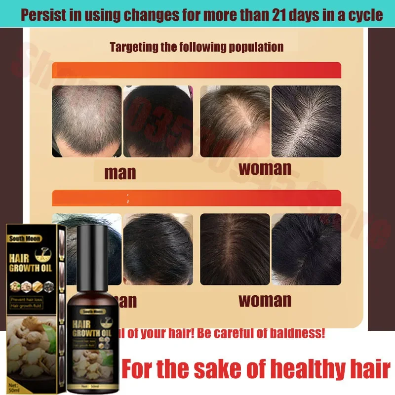 Anti hair loss and growth liquid stabilizes hair roots, prevents hair loss and growth, increases hair density, and nourishes hai