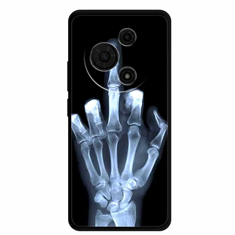 Luxury Rose Fashion Shockproof Silicone Soft TPU Phone Case Cover