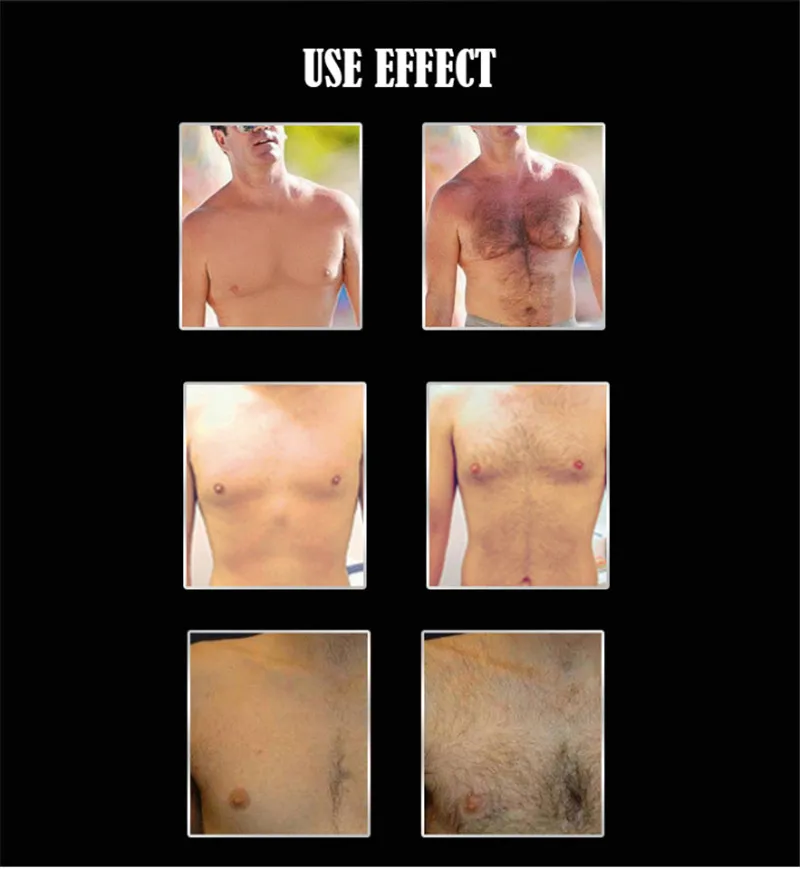 Professional_Men_Beard_Growth_Enhancer_Facial_Nutrition_Moustache_Grow_Beard_Shaping_Tool_Beard_care_products_15