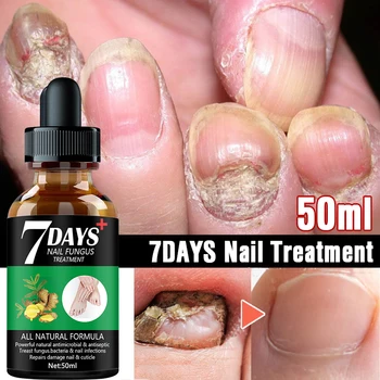 7DAYS Nail Fungus Treatment Essence Serum Care Hand and Foot Care Removal Repair Gel Anti-infective 4