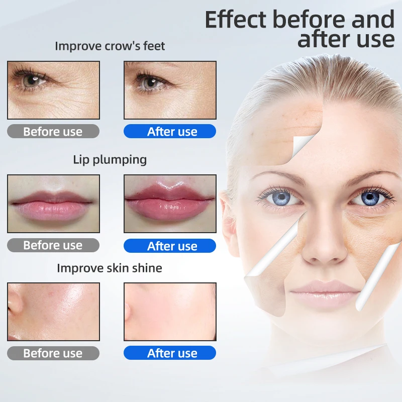 0.3&0.5ml Disposable Syringe Ampoule Head For Hyaluron Pen Lip Filler Lifting Hyaluronic Acid Gun Filler Injection Ampoule Head