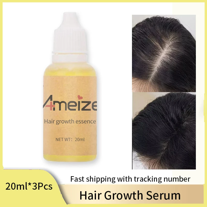 

3 шт. Ameize жидкий шампунь для роста волос биотин восстанавливающее масло против выпадения волос лечение истончения волос для мужчин женщин 20 мл без коробки