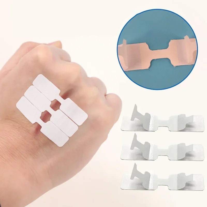 Stitch-Free Adhesive Bandages 2