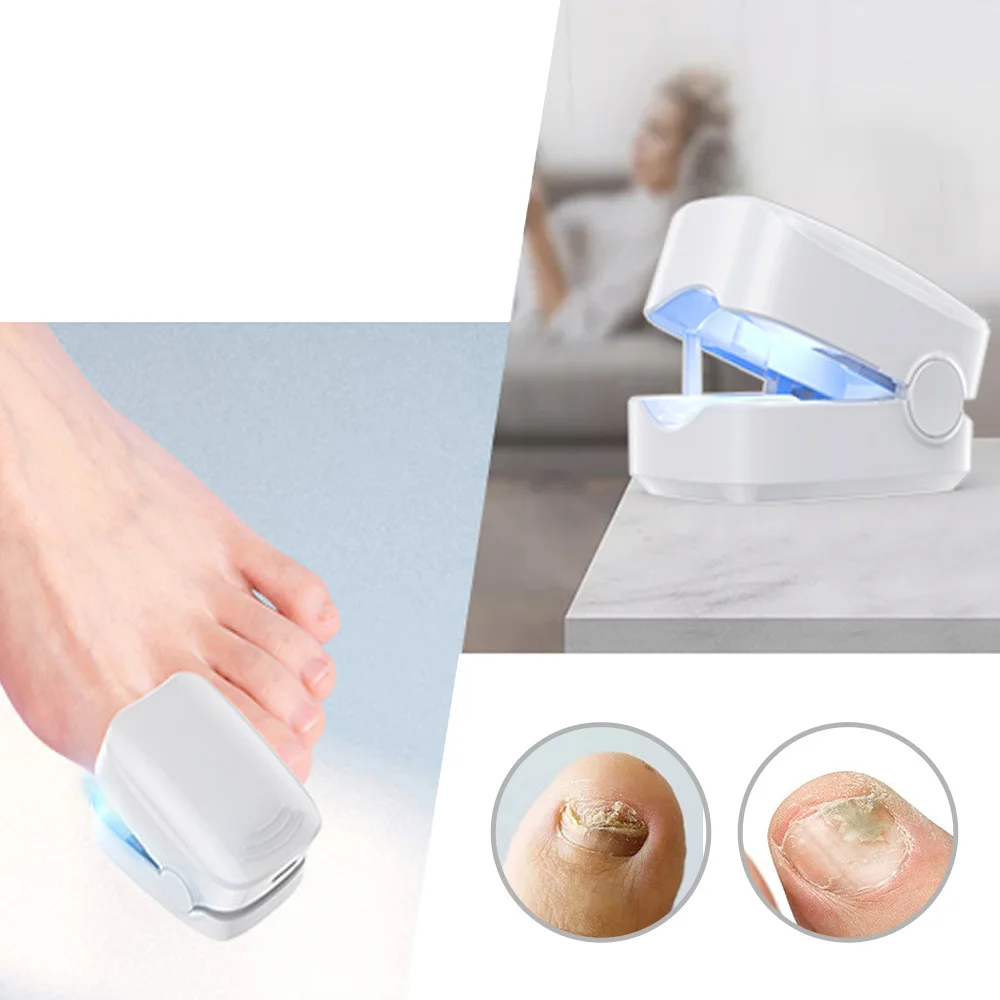 Mini Nail Fungus Laser Treatment Device Repair Toenail Fingernail Fungus Treat Onychomycosis Therapy Cure Effectively Remover