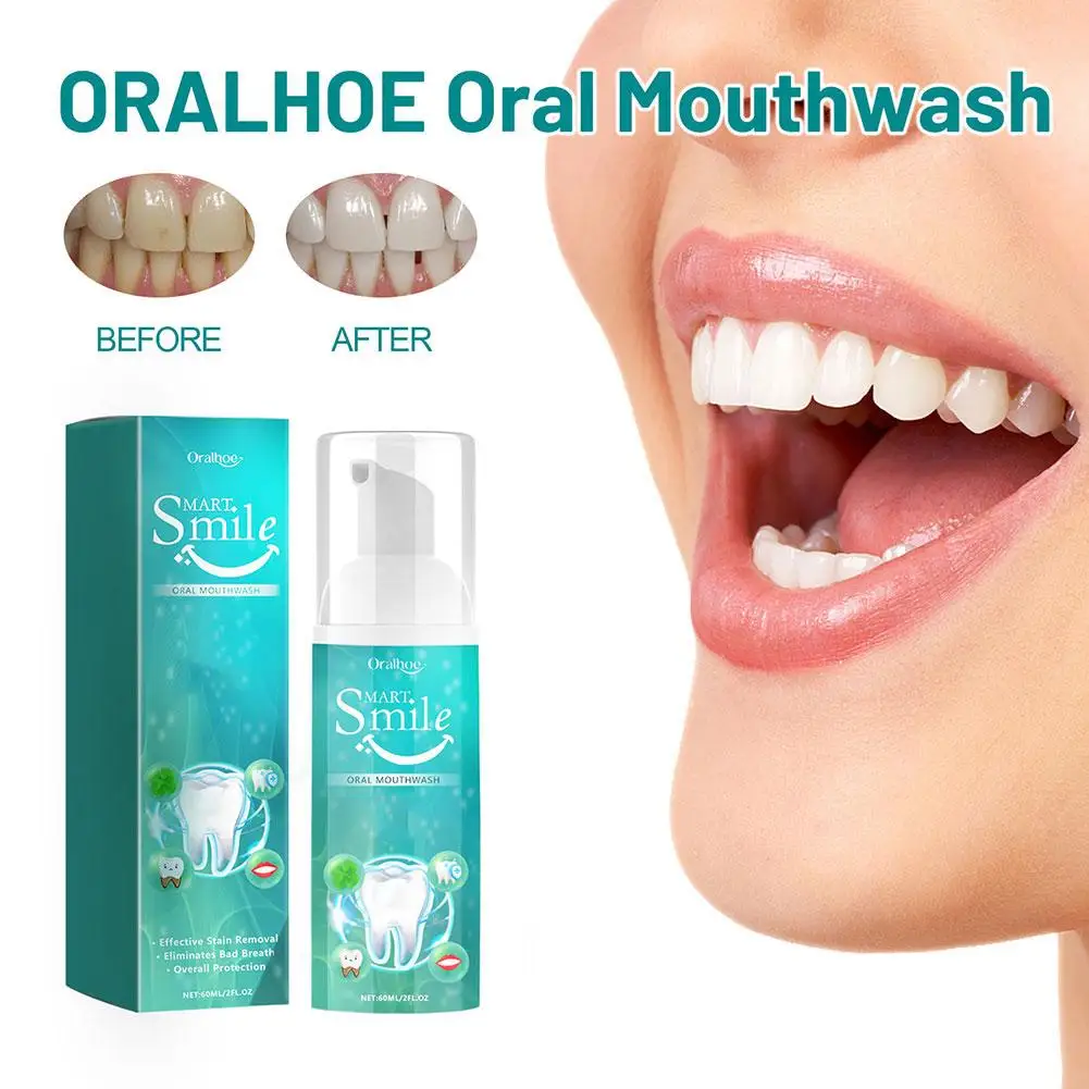 

Teeth Cleansing Mousse Remove Plaque Stains Breath Oral Repair Toothpaste Whitening Freshen Foam Dental Gingival Caries Hyg O5Y0