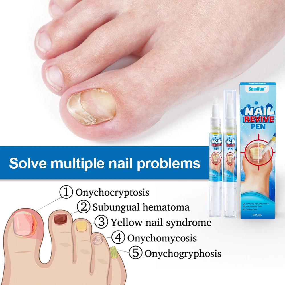 Nail Fungus Laser Treatment Device Care Tool