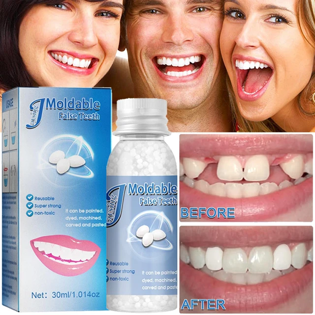 30ML Temporary Tooth Repair Solid Glue Temporary Tooth Repair Set Moldable  Dental False Teeth and Restoration Dental Veneers Resin False Teeth Filling  Glue Moldable False Teeth