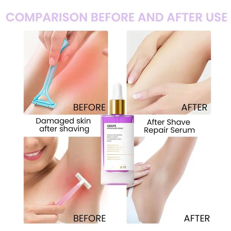 After Shave Oil 90ml Portable Grape Scented Body Oil Hair Removal Supplies Ingrown Hair Moisturizer Women Shaving Care Dry Skin