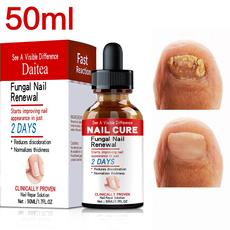 Nail fungus treatment foot care serum foot repair nail fungus removal