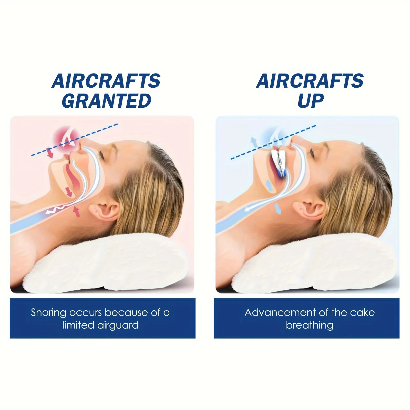1pc Anti-Snoring Braces, Anti-Snoring Anti-Molar Breathing Smoothing Mouth Guard, Anti-Snoring Braces, Protective Teeth Braces 2