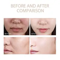 Dr. Melaxin Rice Exfoliating Serum Facial Moisturizing Soften Serum Blackhead Removal Hydrating Pore Shrinking Korean Skin Care 6