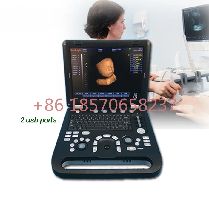 

Portable USG 4D ultrasound machine Laptop color 3D digital ultrasound