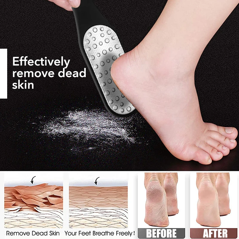 https://ae01.alicdn.com/kf/S45896bf4a5c34a82bdb72fde43cd4f5e6/Double-Sided-Foot-Rasp-Foot-File-Callus-Remover-Sanding-Rasp-File-Cuticle-Footholds-Scraper-Pedicure-For.jpg