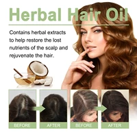 100ml huile de croissance des cheveux inde Adivasi soins capillaires à base de plantes réparation au romarin hydrater endommagé hydrater le cuir chevelu réduire les pellicules 2
