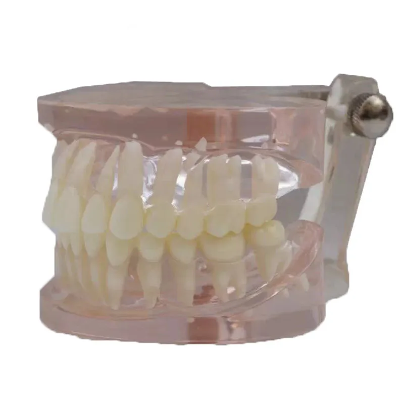 

Dental Supplies Standard Tooth Model for Study