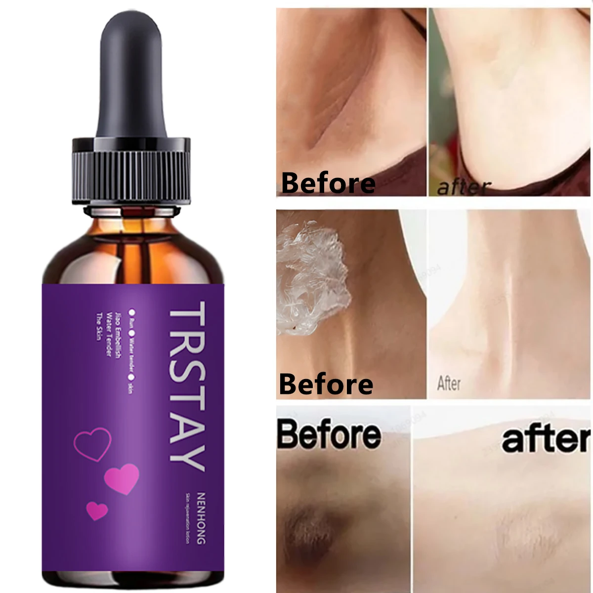 

TRSTAY Hair Removal Cream Specially Used for Removing Underarm Leg Hair, Removing Whole Body Bikini Hair Removal