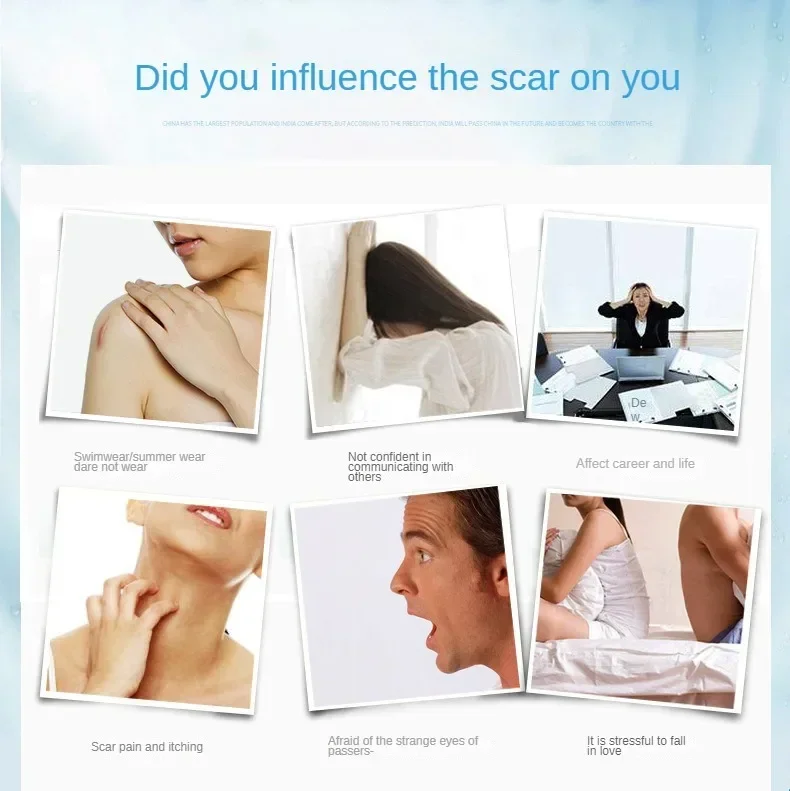 Scar Removal Cream Gel Remove Acne Spots Treatment Stretch Marks Burn Surgical Scar Repair Cream Smoothing Whitening Skin Beauty