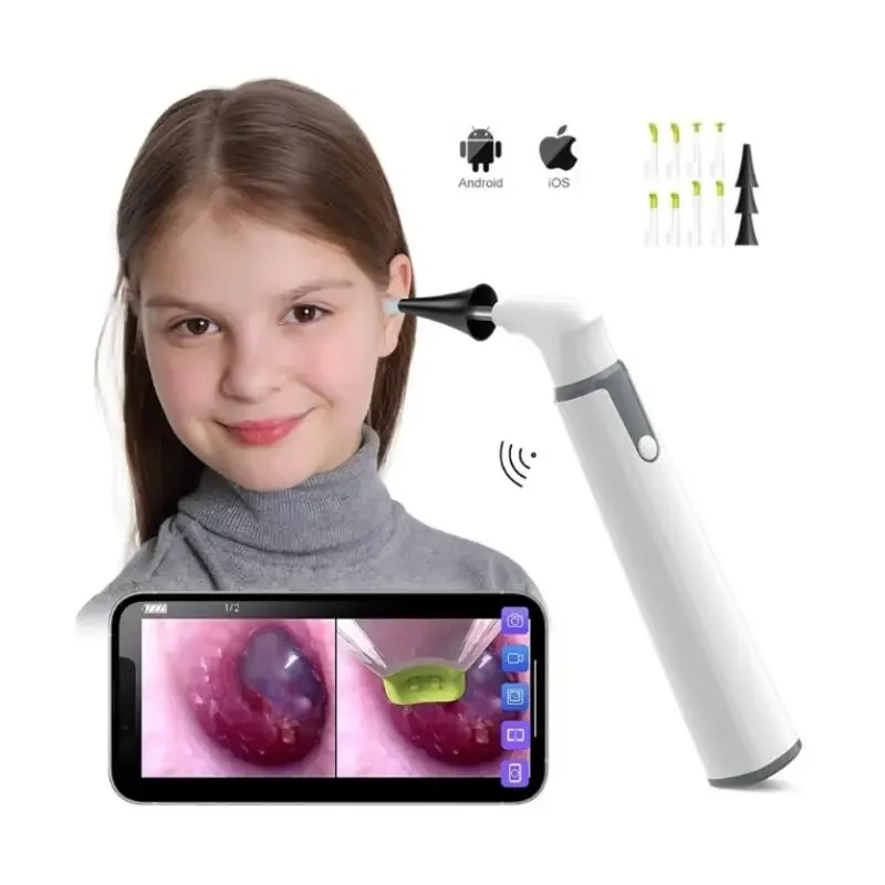 Ear Wax Cleaner Digital Otoscope Wifi Ear Otoscope 1/2/3/5/10PCS 3.9mm Smart Wireless Portable Visual Earwax Cleaning Visible light Ear Spoon Endoscope for Phone