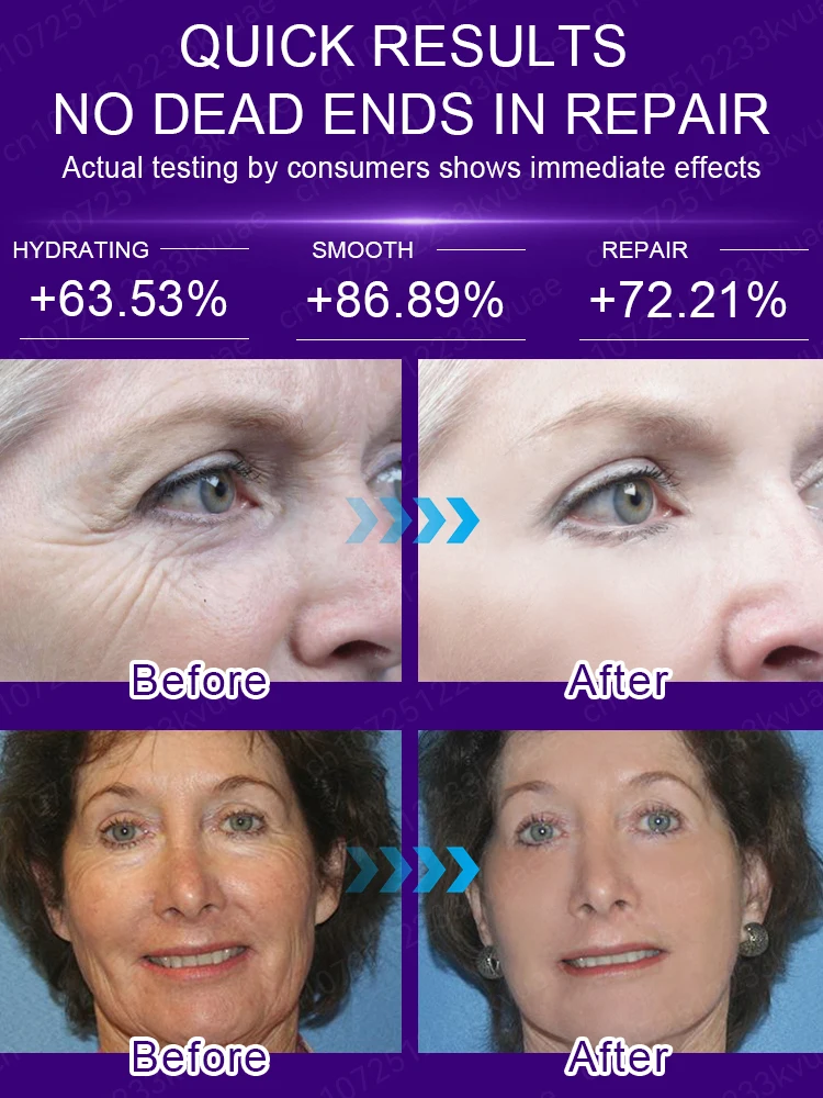 20 years younger，Wrinkles disappear 3