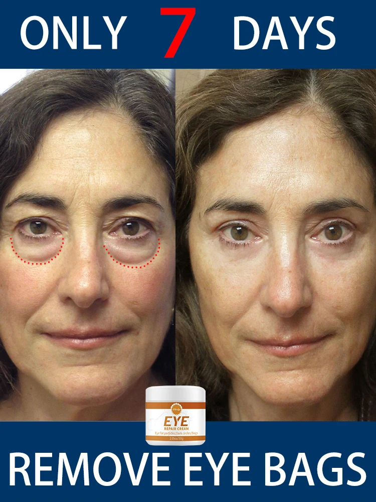 

eye bag cream repair dark circles