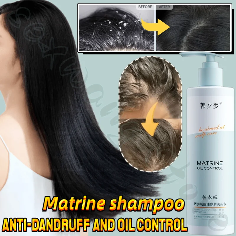 

Matrine Shampoo, Anti-dandruff, Anti-itch, Seborrheic, Oil-control, Deep Cleansing Scalp Shampoo, Head Care 300ml