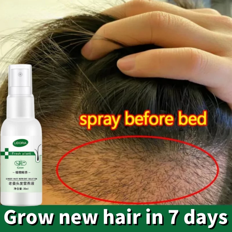 

Fast Stimulate Hair Growth Serum Spray Prevent Baldness Anti Hair Loss Treatment Oil Repair Nourish Hair Root Regrowth Hair Care