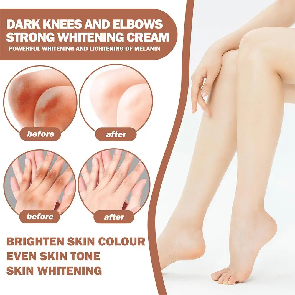 Whitening Cream Private Parts Underarm Bleaching Serum Whiten Butt Knee Brighten Inner Thigh Intimate Parts Dark Remove Melanin 6