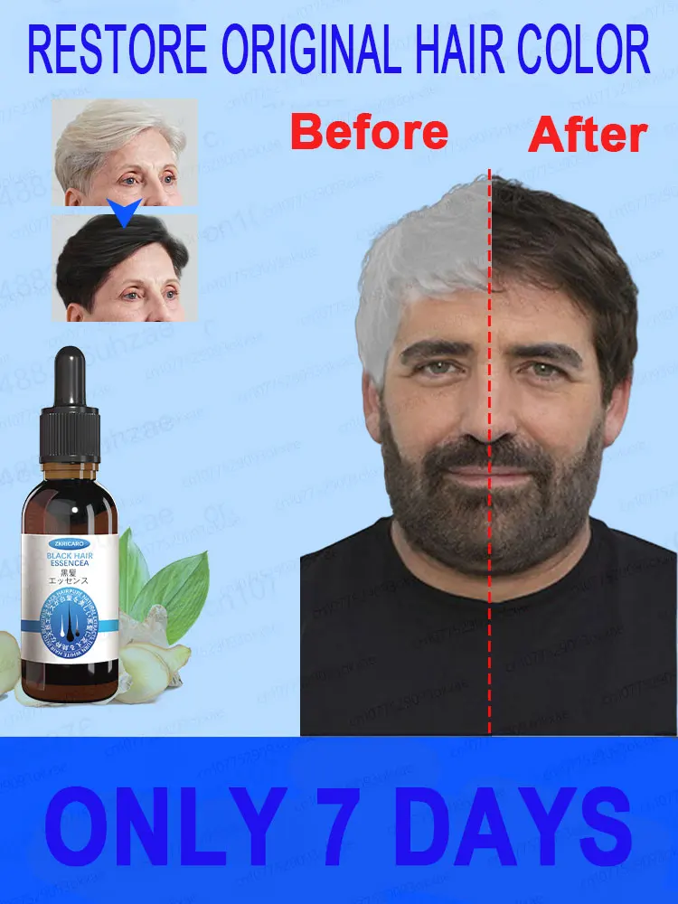 White hair killer, remove gray hair and restore natural hair color in 7 days