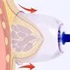 2 Pieces Enlarge Breast Cupping for Female Breast Massager Chinese Vacuum Set 13.5cm Female Cupping Massage Vacuum Cup Set 1