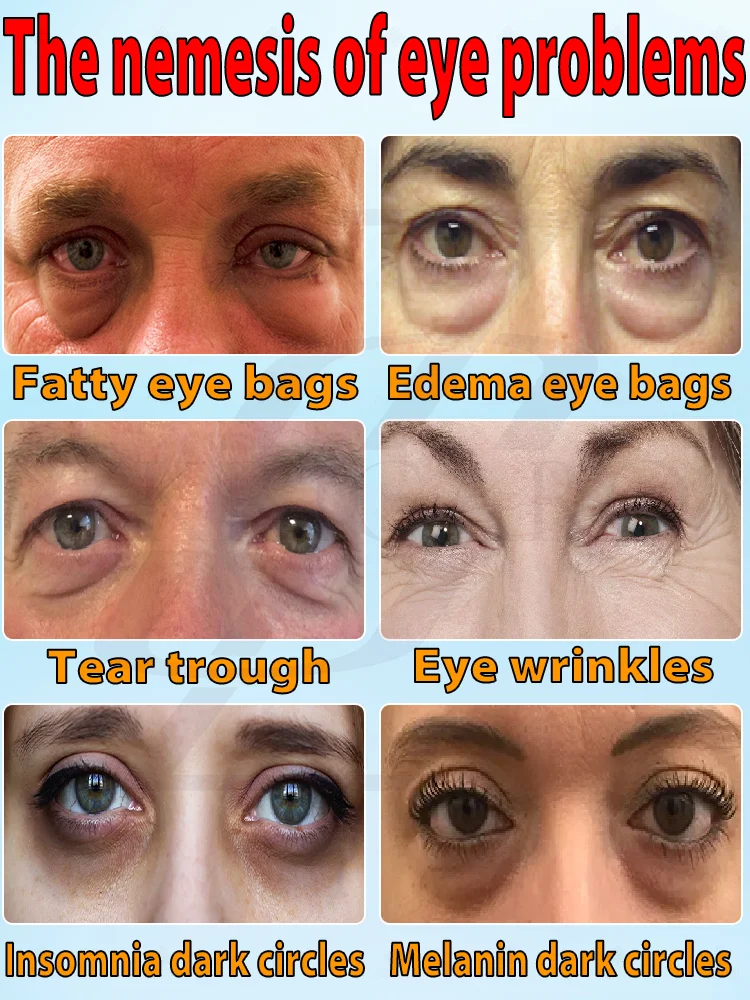 Eye cream anti wrinkle brightens and removes dark circles
