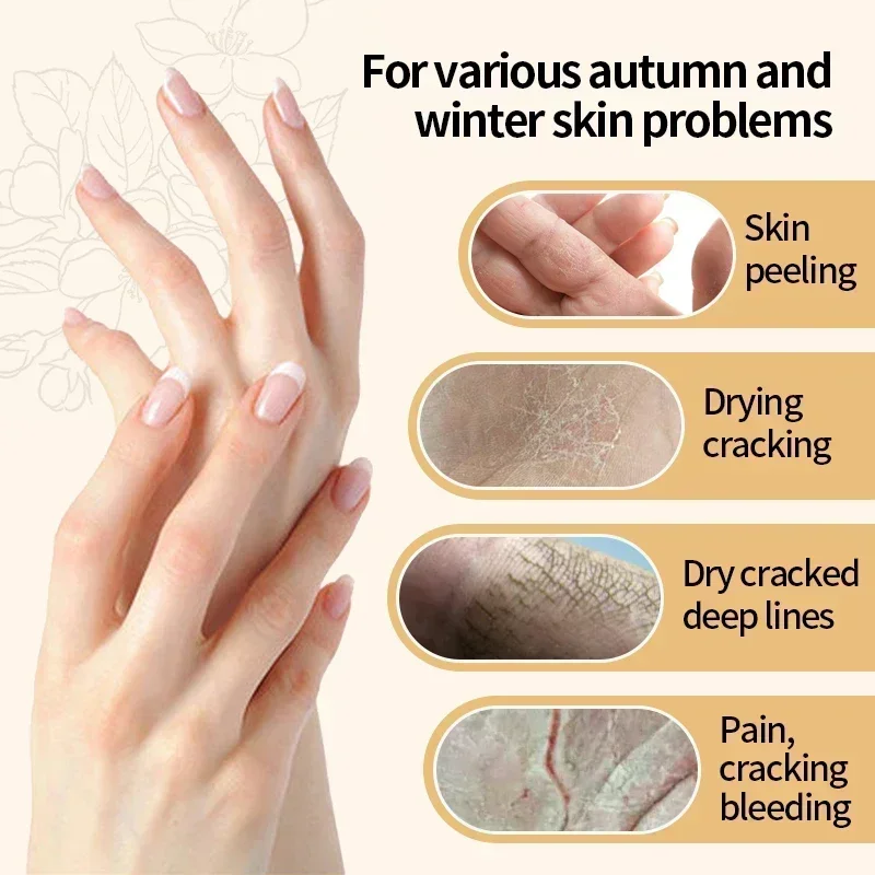 Kojic Acid Anti-wrinkle Hand Cream Skin Soften Nourish Anti-drying Whitening Moisturizing Korean SkinCare Cracked Repair Product