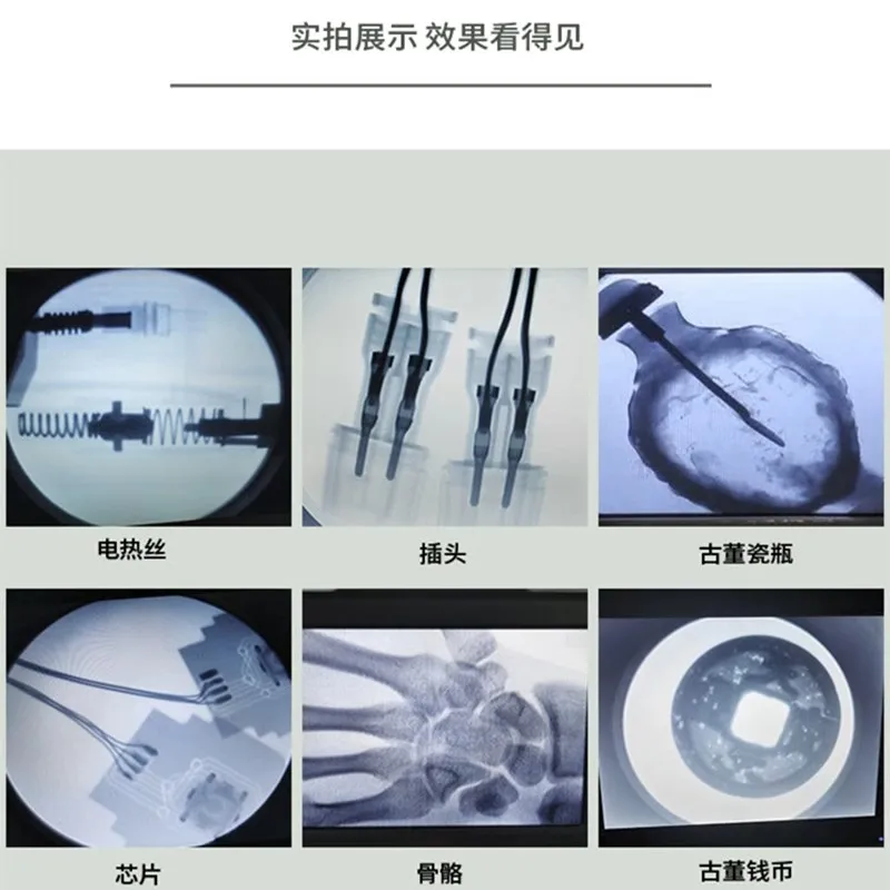 Machine portable de fluoroscopie à rayons X pour l'orthopédie des membres, la photographie clinique à haute définition, la radiographie des animaux de compagnie