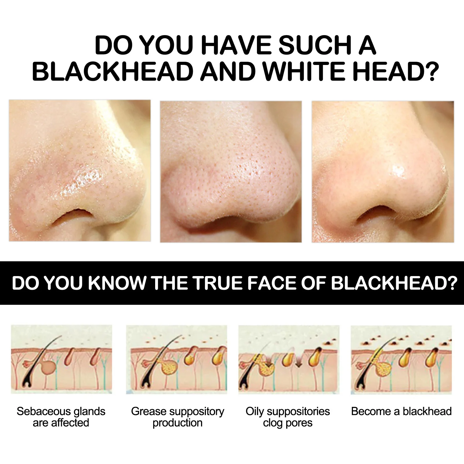 Nose Blackhead Remover Cream Peel Nasal Strips Deep Cleansing Shrink Pore Nose Black Dots Remove Stickers Skin Care Makeup 6