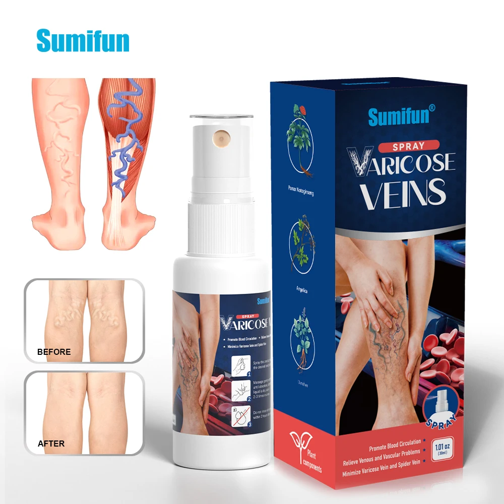 

30ml Sumifun Varicose Vein Spray Vasculitis Phlebitis Relief Herbal Cream Spider Legs Treatment Smoothing Blood Vessel Redness