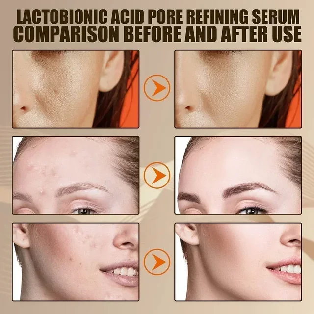 Sérum Facial de Ácido Lactobiônico para Poros Dilatados e Pele Radiante