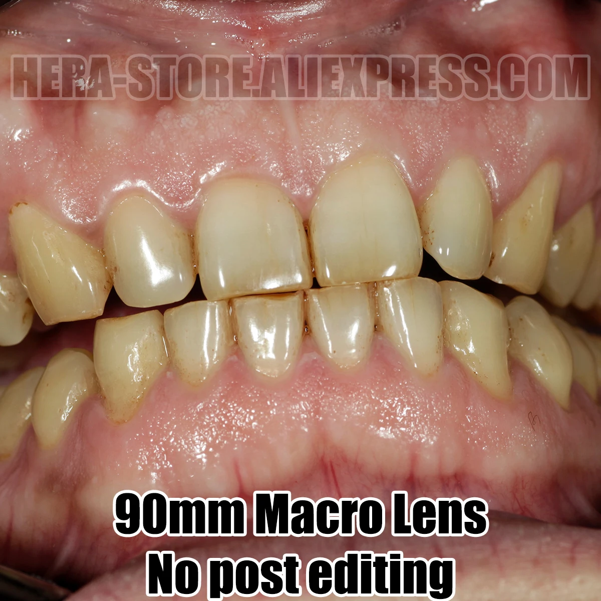 Macro And Dental Photography SLR DSLR Camera Twin Flash Bracket With Godox Flash And Godox Trigger For Dentist