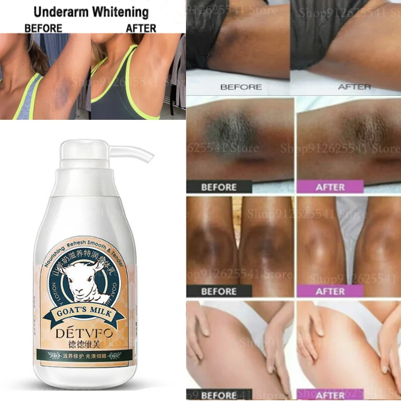 300ml Instant Whitening Remove Melanin Body Lotion Goat Milk Body Lotion for Black Skin Brightening Lightening Nourishing deep cleaning remove black spots moisturizing face cream carbon gel for laser skin rejuvenation skin whitening skin skin massage