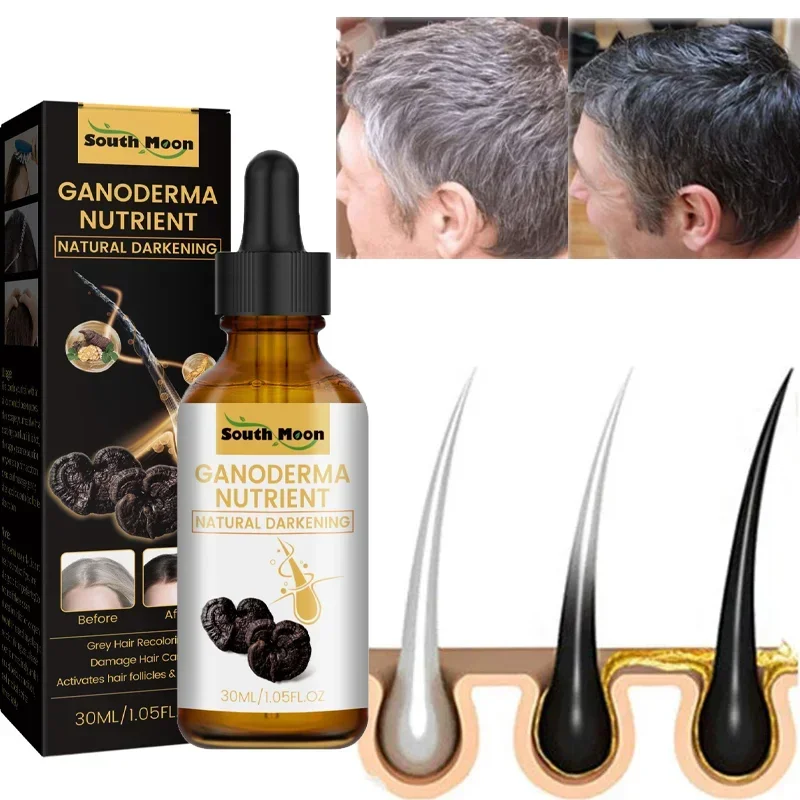 Hair Care Gray White Hair Treatment Serum Liquid White To Black Scalp Dry Damaged Beard Essential Oils Repair Nourish Product Hair Treatment Oil Scalp Treatment