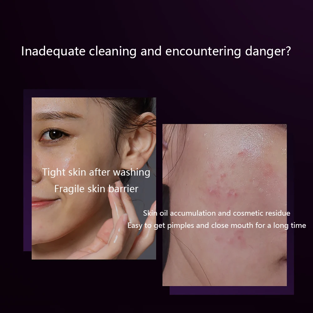 Facial Cleanser Pores Soothing Dry Skin Hydrate Foam Miantong Cleansing Blackhead Remover Face Wash Korean bubble skin care 2
