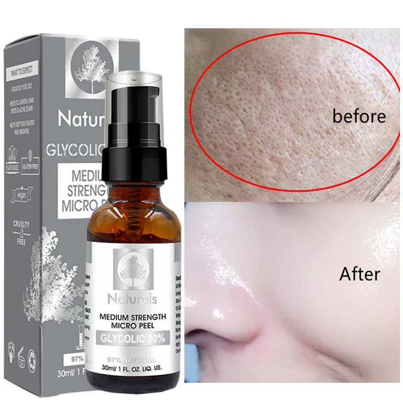 Glycolic Acid 30 Shrink Pores Face Serum Cleaning Exfoliating Essence