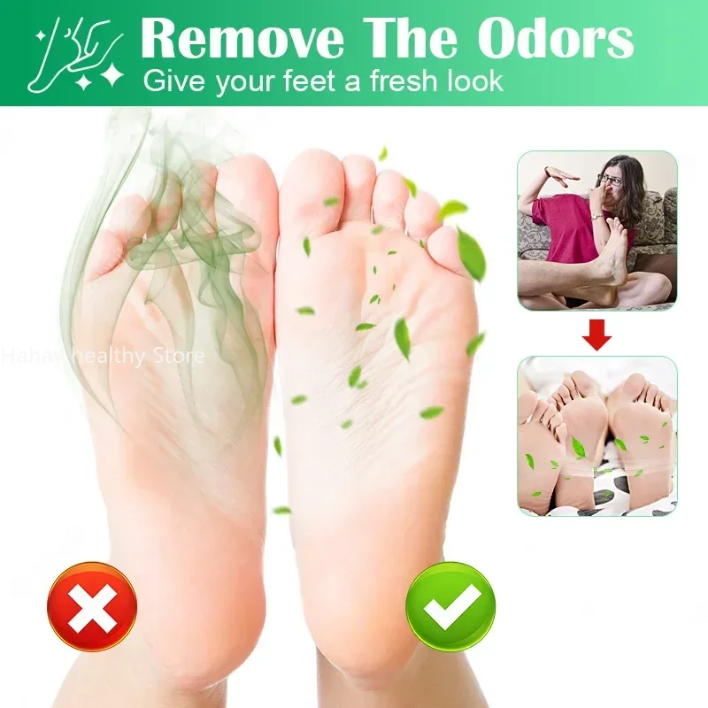 Deodorant Ointment Foot Athlete's Foot Ointment Feet Odor Care Cream Fungal Treatment Clean-smelling Beleza E Sa&uacute;de