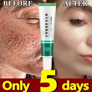 Salicylic Acid Pore Cream 1