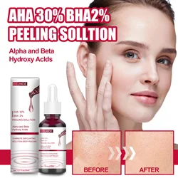 Face Whitening Peeling Solution AHA 30%+BHA 2% Fruit Acid Salicylic Acid Acne Remove Serum Repair Hyaluronic Acid Face Skin Care