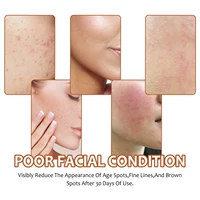 Savon à l'acide kojique au citron et au curcuma, éclaircissant, nettoyant en profondeur, brillant, rajeunissant, exfoliant, même le teint de la peau, fait à la main 3