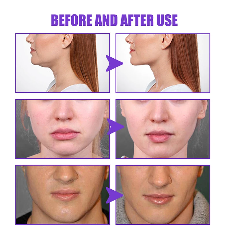 Skinny Face Cream Double Chin Remover
