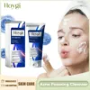 Facial Cleanser Anti Acne Oil Control Blackhead Remover Shrink Pores Deep Cleansing Acne Treatment Moisturizing Face Wash 100g 1