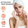 200pcs Star Shape Pimple Patches Colorful Hydrocolloid Pimple Healing Sticker Cute Strong Absorption Zit Patches Face Care 5