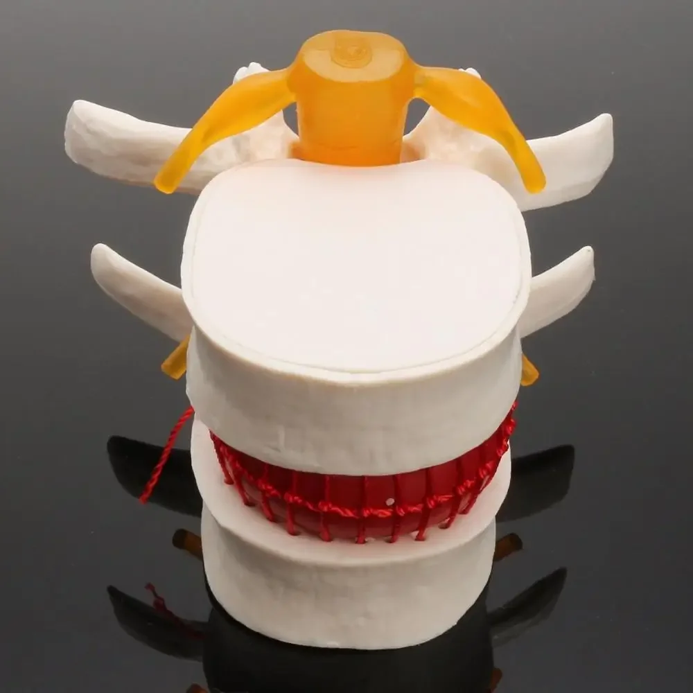 Human Anatomy Skeleton Spine Lumbar Disc Herniation Teaching Model Brain Skull Traumatic Pistol School Supplies Medical Instrument human skull model